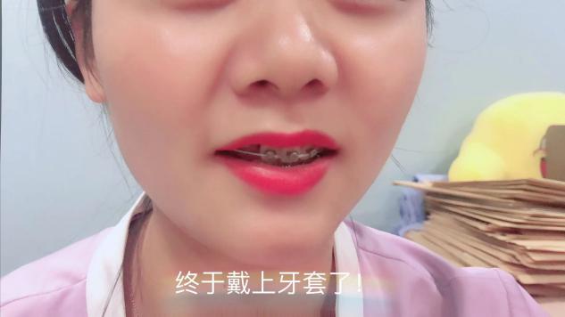 我戴牙套了日记,我戴了牙套两天牙齿松