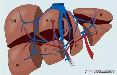 门静脉高压引起的肝硬化怎么治疗,肝硬化门静脉高压吃中药能缓解吗