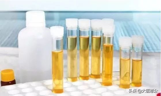 尿黄尿味大难闻是什么原因,太监身上有尿骚原因