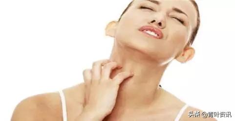 季节性过敏的5种天然良药,秋冬皮肤过敏用什么好得快