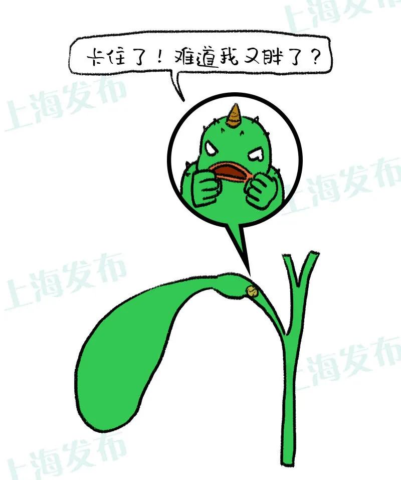 一招解决胆结石的方法,胆结石最快止疼方法穴位