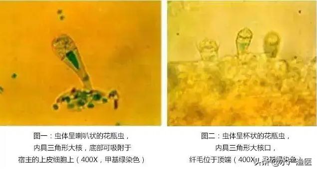 养殖鱼常见体外寄生虫,23种鱼类寄生虫图片库