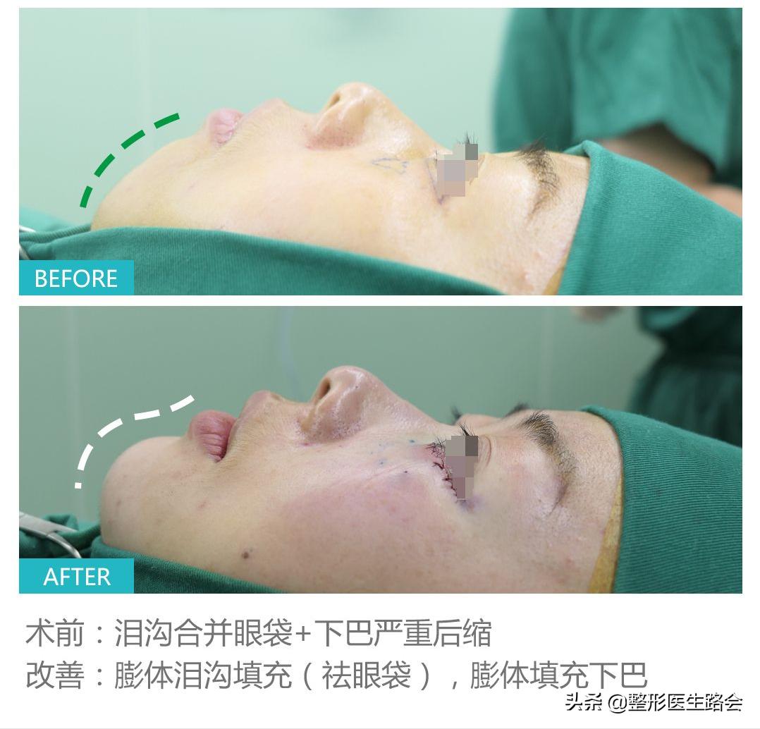 这6个坏习惯会让你越来越胖,这6种坏习惯会毁了孩子一生