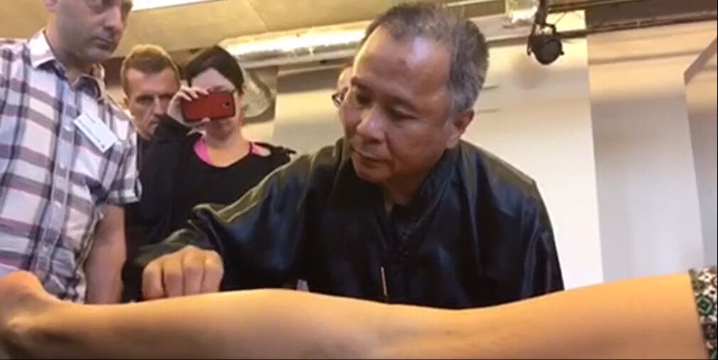 中医治疗肌无力的效果怎么样,中医治疗肌无力的好方子