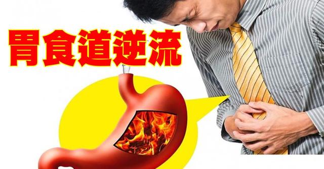 一直反酸水食道有灼烧感消化不良,胃胀胃酸烧心食管反流吃什么药好