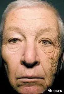 长期用防晒霜发现脸变白了,坚持涂防晒之后皮肤的改变