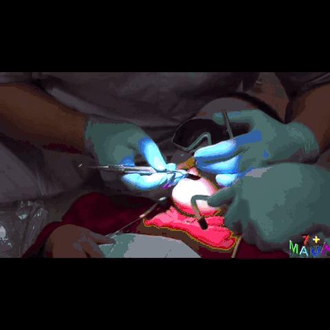 小孩可以洗牙视频,儿童可以洗牙吗洗牙的过程是什么