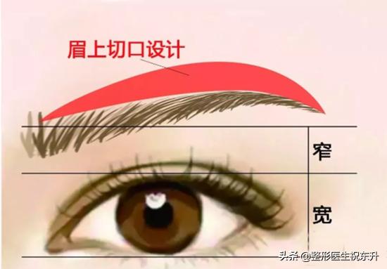 妈妈想做眉毛,哪些人群适合做提眉