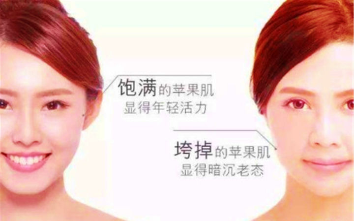 改善颧骨的10个方法,颧骨美学