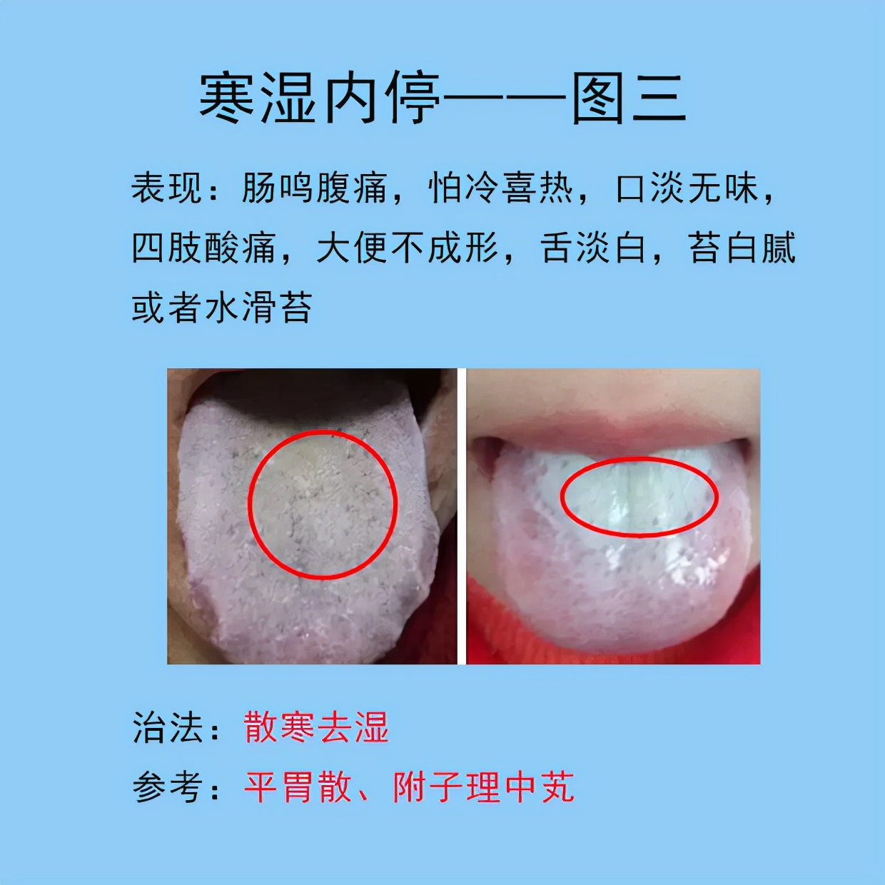 根据舌象判断用哪种调理脾胃的药,脾胃常见的症状