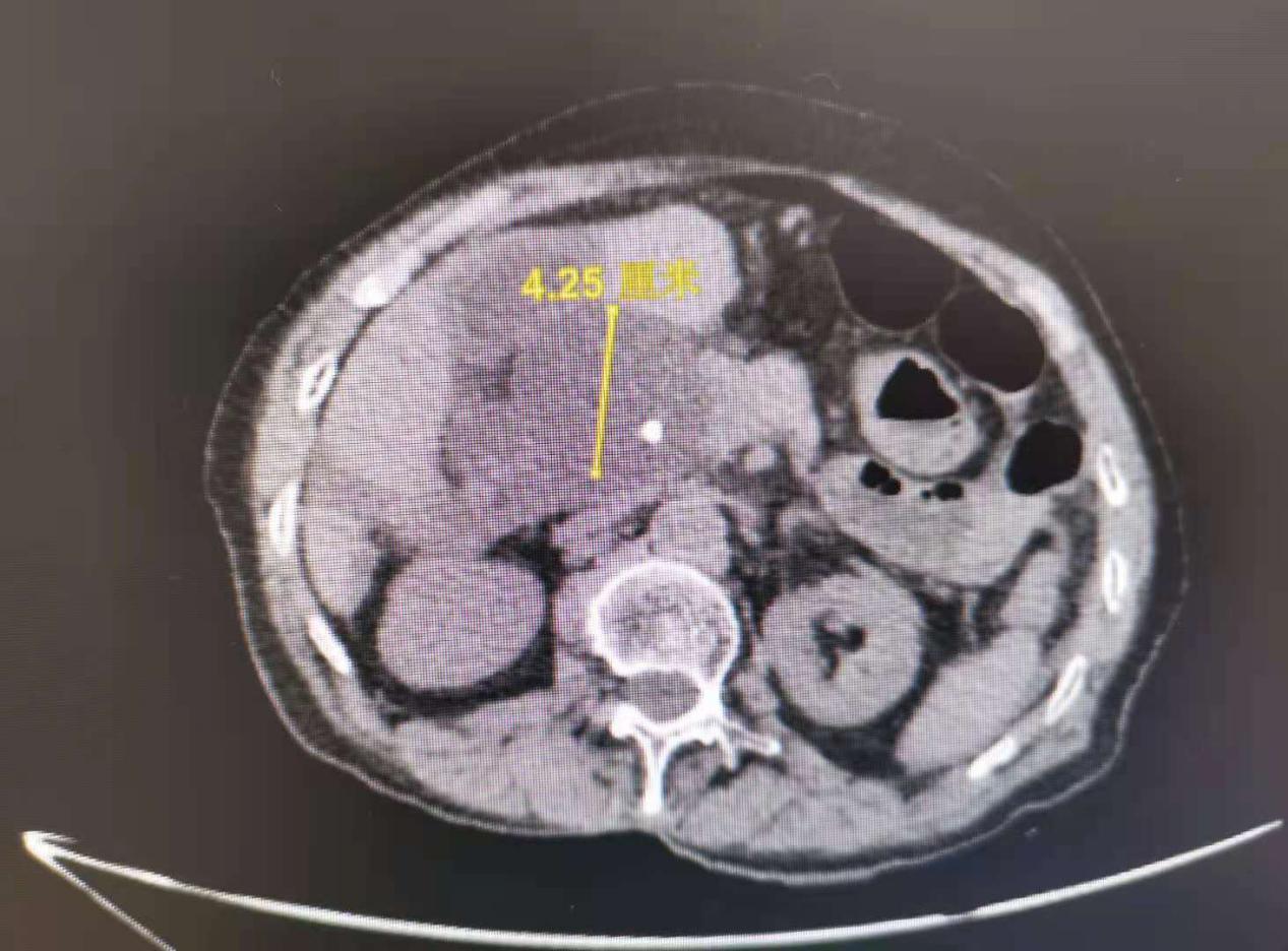 南大二附院红角洲分院具体位置,南大二附院红角洲分院优势