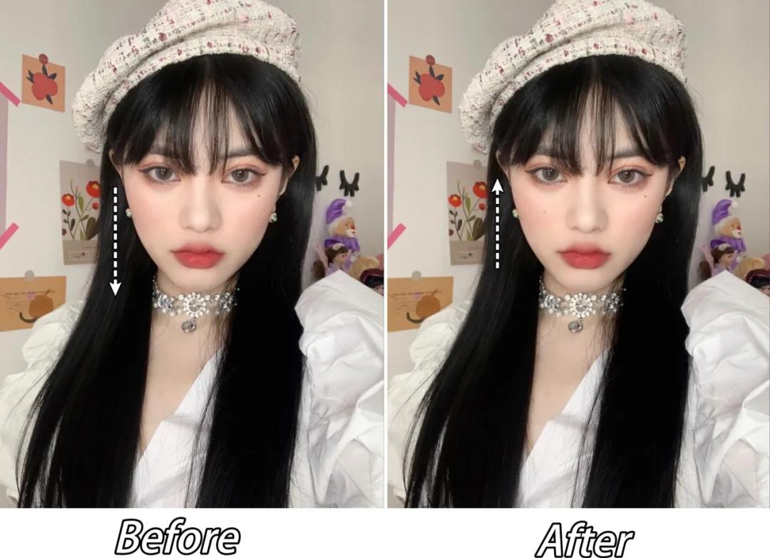 全脸点痣变美,点痣能变美吗