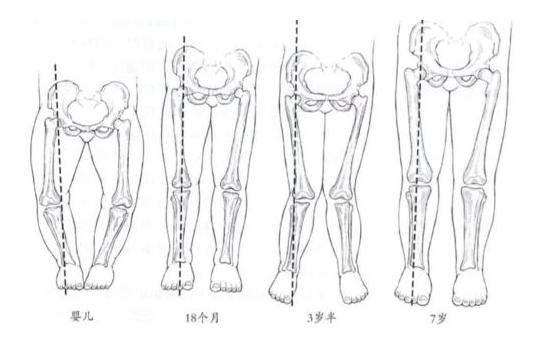 儿童罗圈腿,宝宝有点长短腿罗圈腿
