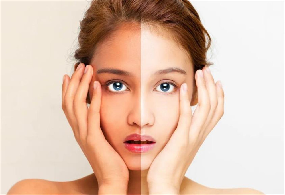 肤色暗沉色素堆积怎么办,色素沉着差如何调理