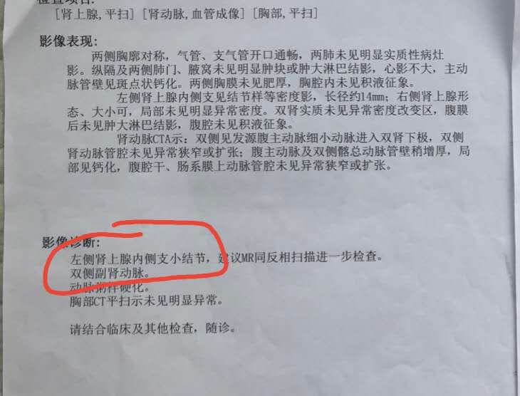 心衰脑梗血压高,43岁得了心衰和脑梗还有救吗