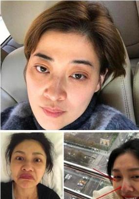 常年黑眼圈护肤品没效果,护肤品去黑眼圈用哪种