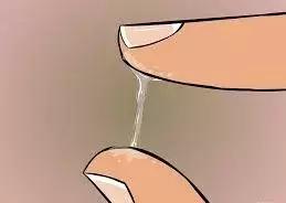 白带异常是怎么回事?今天一次性说清楚