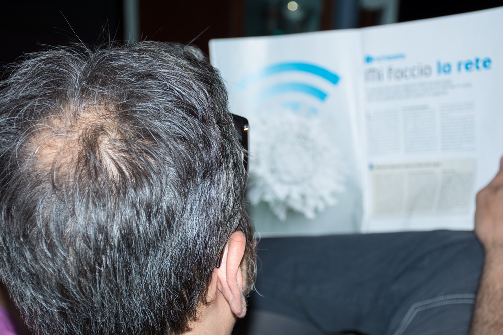 30岁白发脱发原因有哪些,白发脱发的烦恼如何有效解决