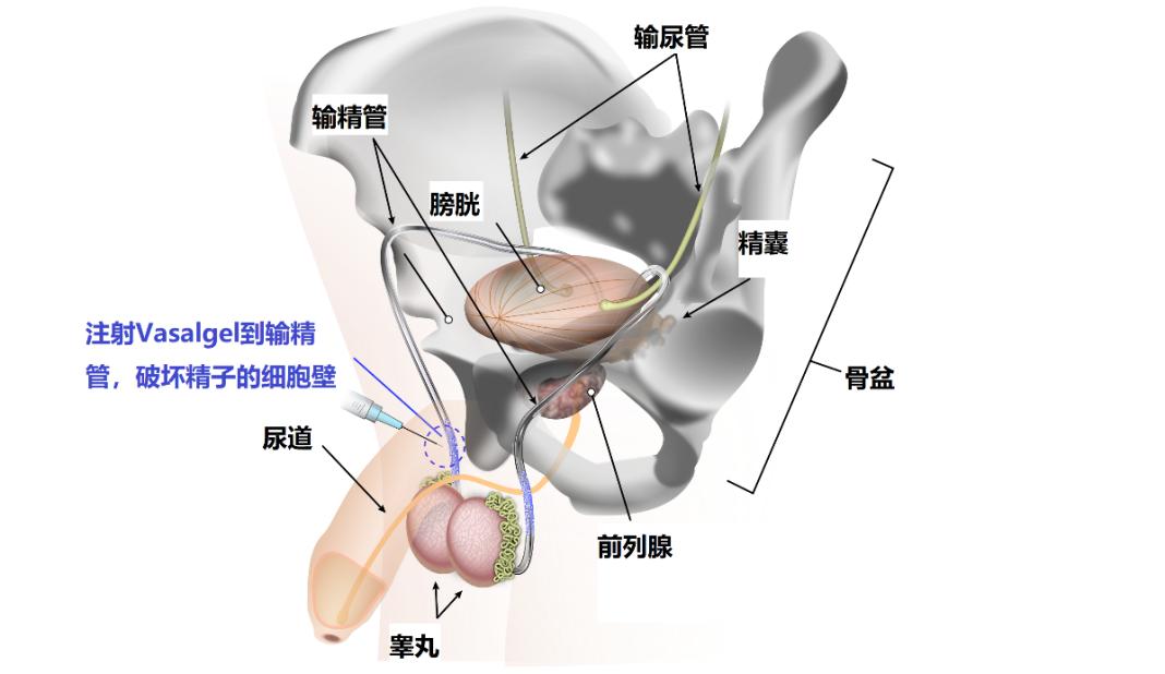 避孕药男性吃了有什么功效,男性吃避孕药会造成脱发吗