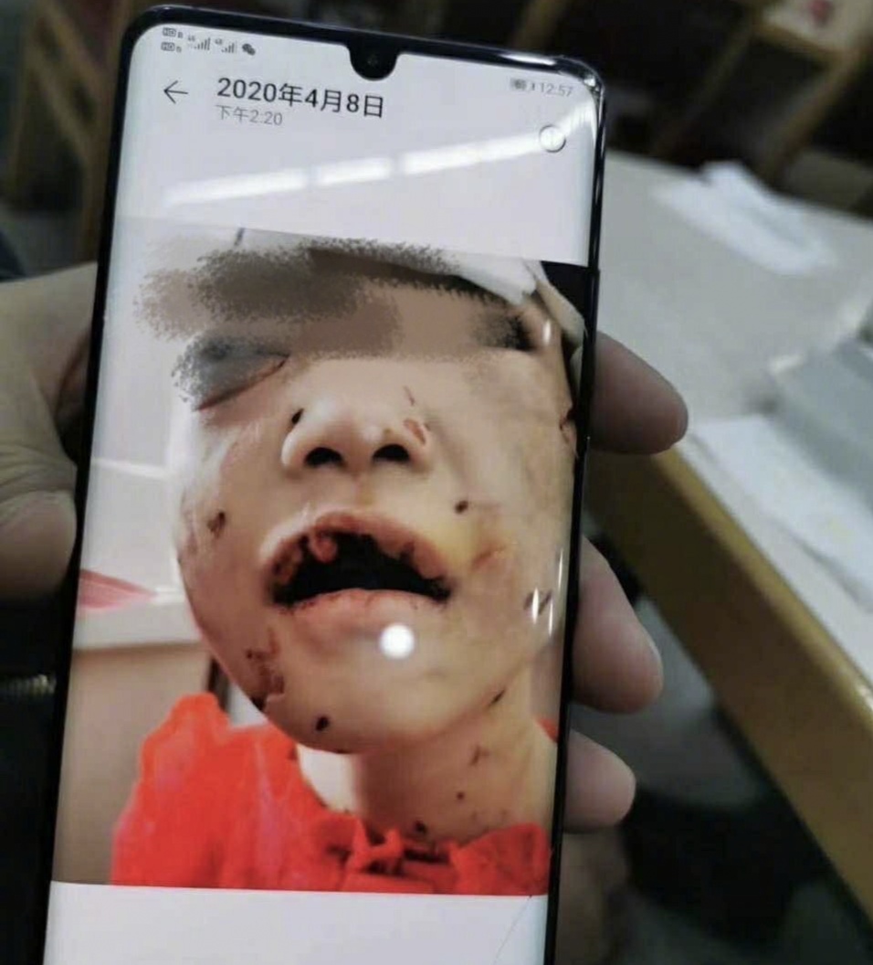 虐童是什么意思,虐童是什么心理