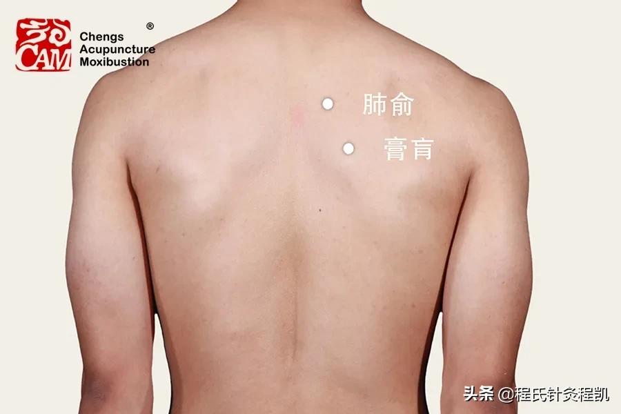 程凯养生说:心脏支架手术术后,如何穴位调养?