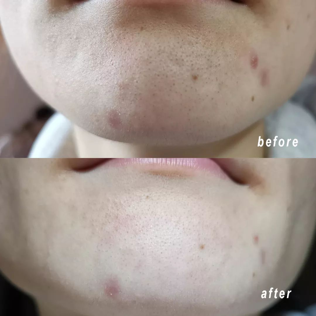 清洁面膜测评踩雷,清洁面膜测评排行榜前十位