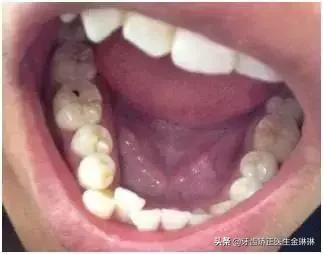 淄博诺尔漫齿科洗牙怎么样,淄博诺尔漫口腔医院