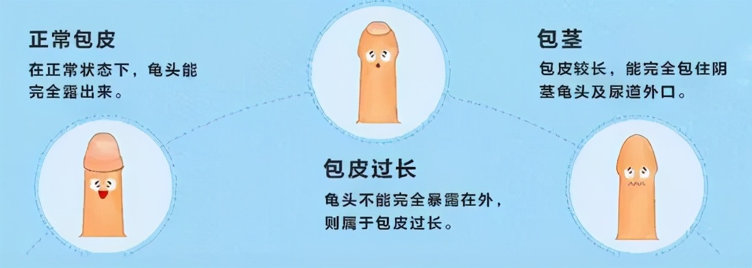 包皮手术去男科医院做靠谱吗,包皮手术前一天必须住院吗