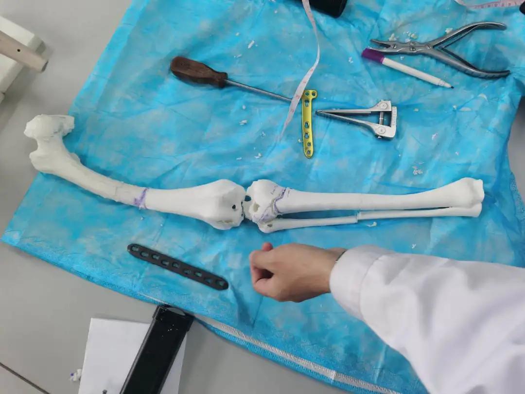 一场截肢手术,一场九死一生的手术