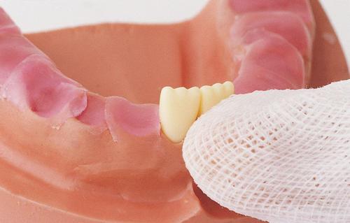 孩子天天刷牙还得龋齿,小孩天天刷牙怎么牙齿还是蛀了