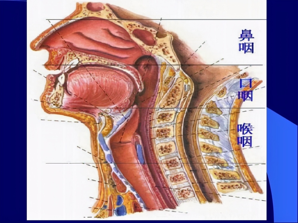 吃槟榔引起扁桃体一边大怎么办,喉咙卡槟榔渣子怎么解决