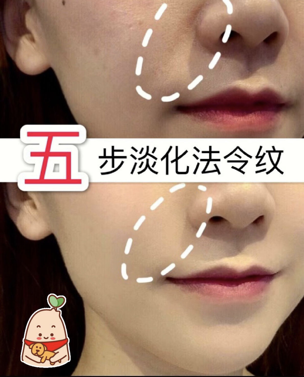 怎样快速淡化法令纹,日本女性淡化法令纹