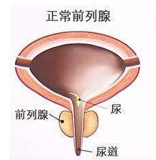 前列腺保健哪里做,前列腺保健一般做哪里