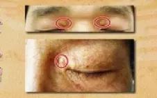 40岁脸部衰老的征兆,中年脸部发生变化是好是坏