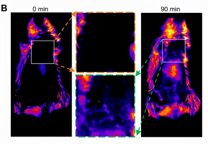 动脉粥样硬化靶向特效药,动脉粥样硬化最新药物研究