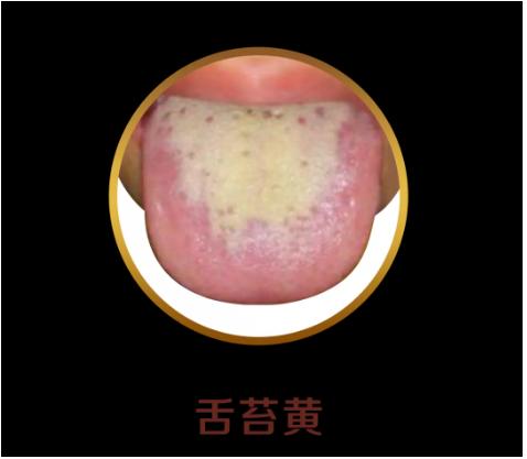 舌头有舌象是什么原因,怎么判断宝宝舌象是否正常