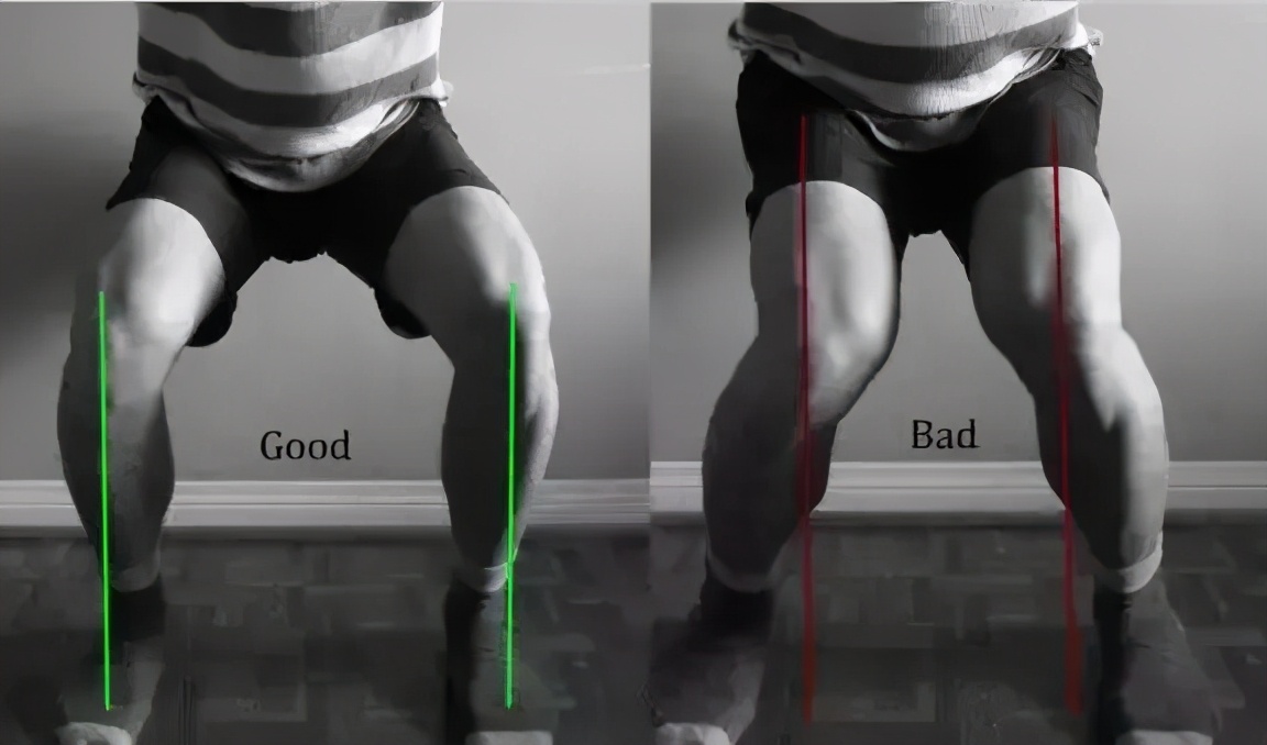 孙怡现实中的腿,孙怡的腿到底直不直