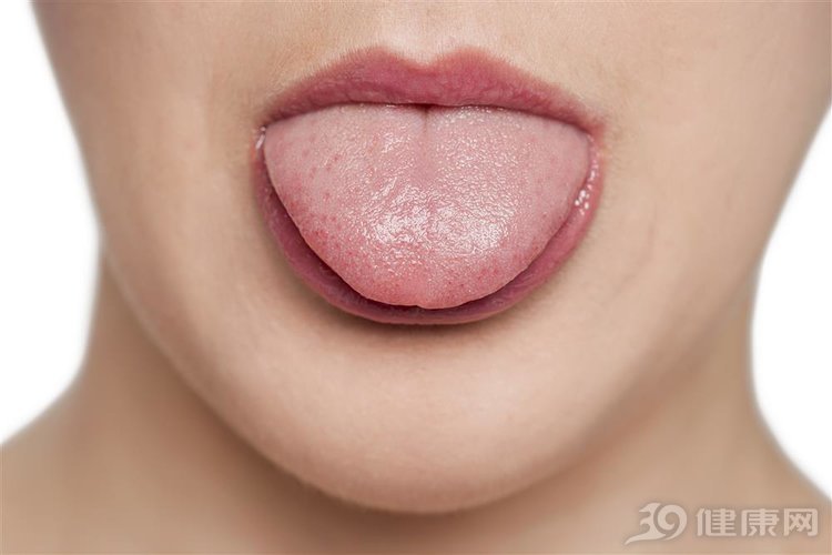 舌苔胖大有齿痕是脾虚还是肾虚,舌苔胖大白腻有齿痕属哪种湿气