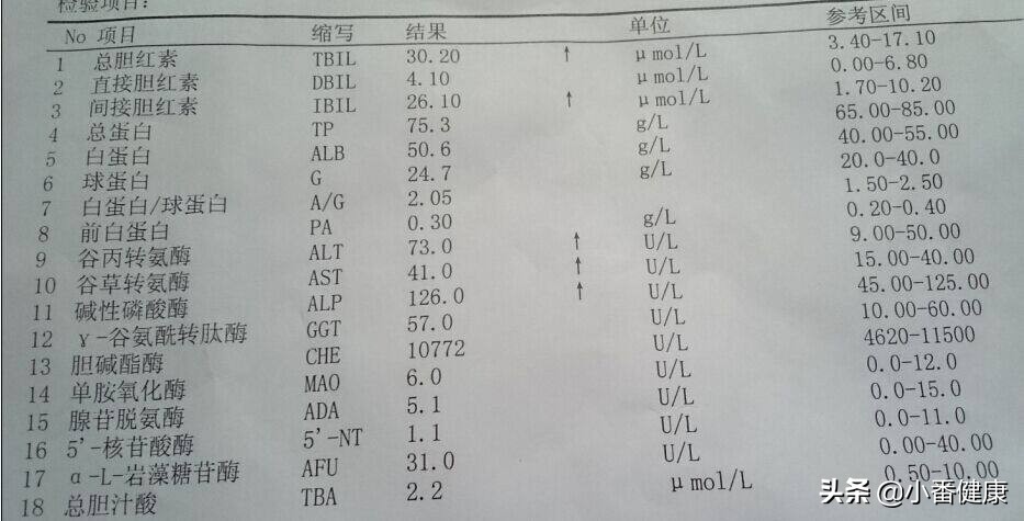 结合病毒基因(DNA),乙肝145阳性者,重视早期肝硬化预防