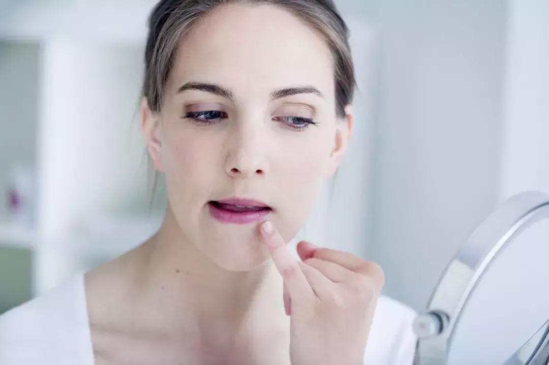 皮肤管理丨假期结束，和你一起上班的可能还有痘痘...