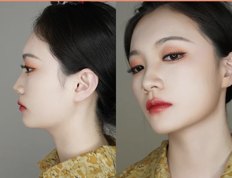 脸颊太瘦如何让脸变得饱满一些,怎样才能让脸变瘦变得好看