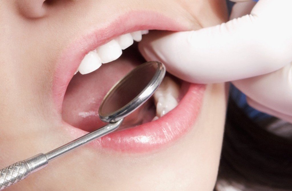 20岁乳牙坏了直接拔掉行吗,20颗乳牙脱落时间