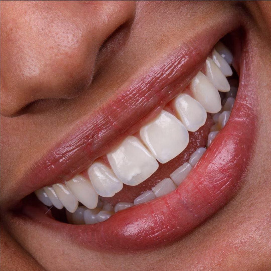 整容不如整牙真的假的,不要整容要整牙