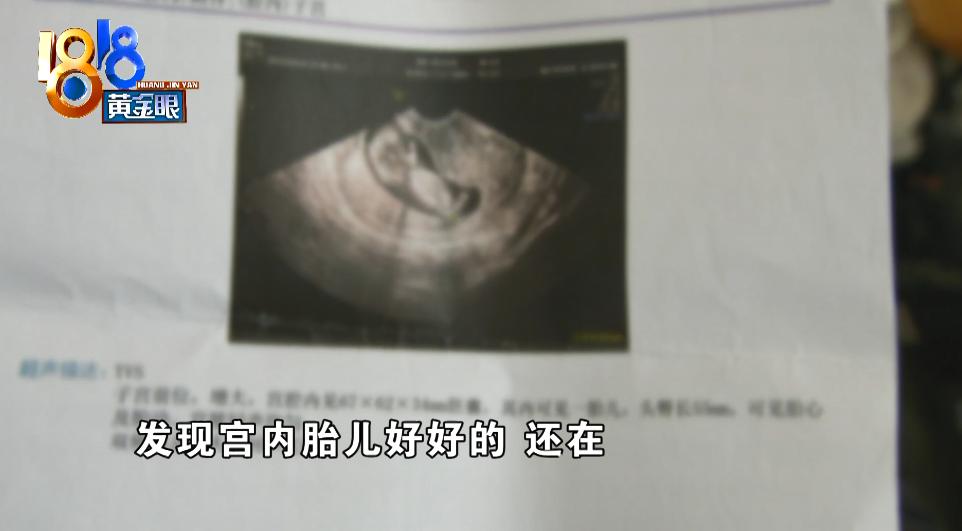 医院清宫会影响胎儿吗,做过清宫会怀不上孩子吗