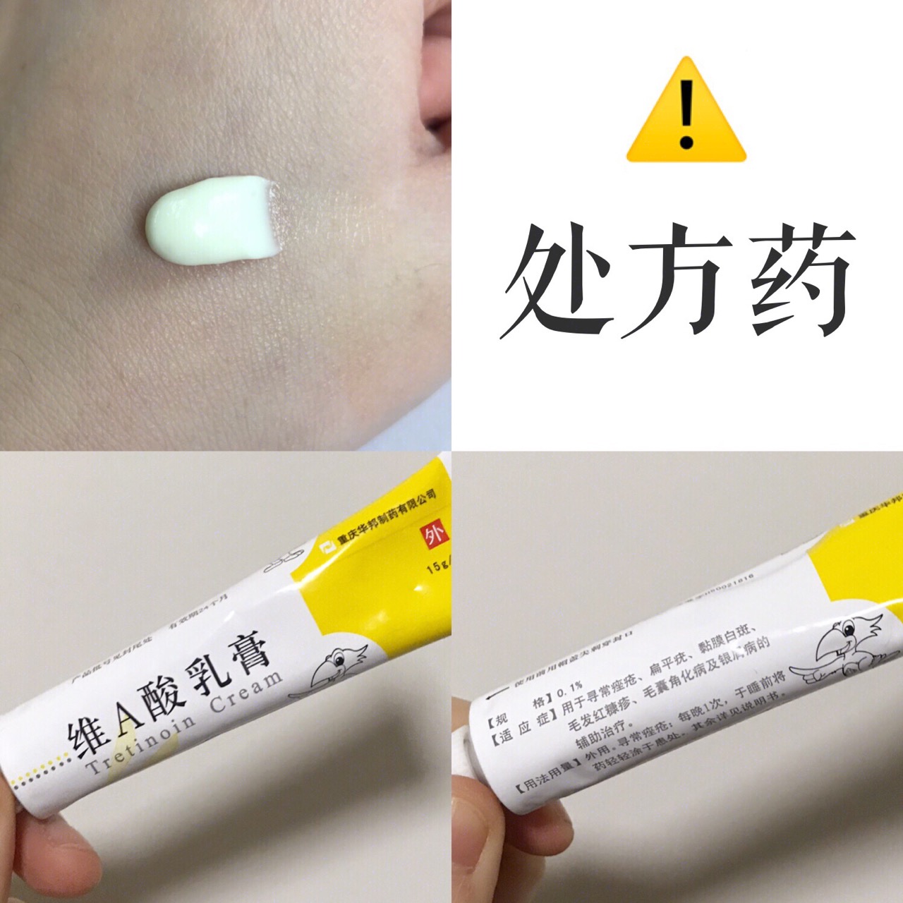 见效超快的祛痘药,女孩子必用的祛痘神器