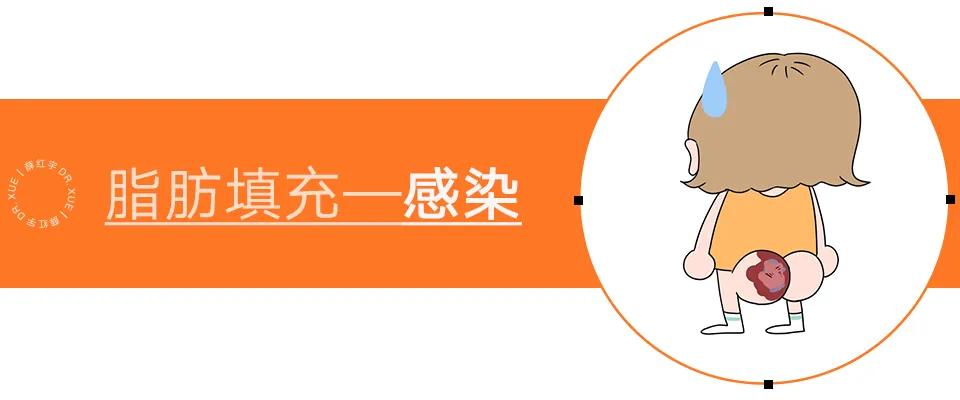 自体脂肪移植后的图片,自体脂肪移植丰胸丰臀