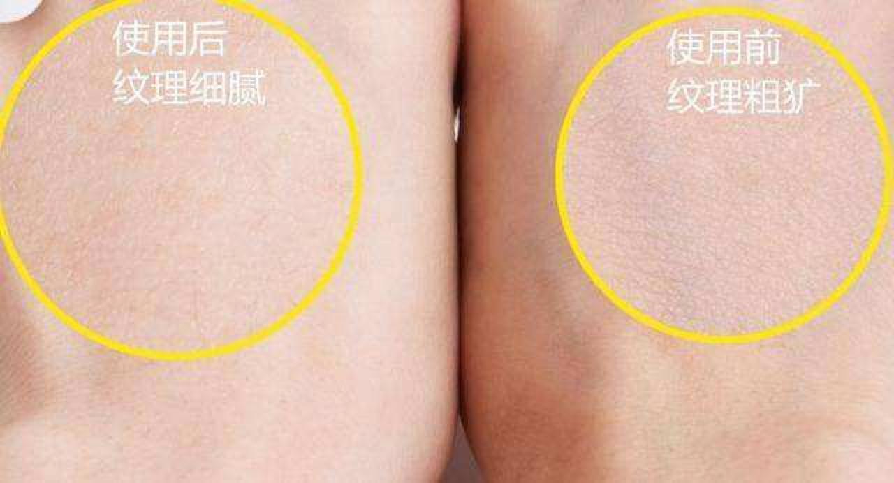 怎样清除脸上的角质,皮肤角质清理指南