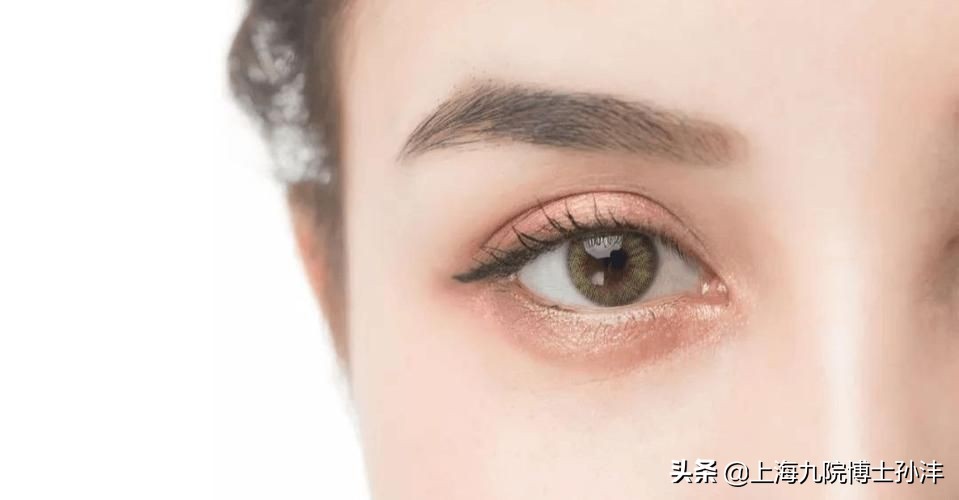 明明是双眼皮却老是不显为什么,为什么割了双眼皮反而不好看了