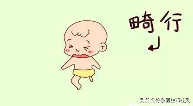 备孕担心孩子畸形需要做什么检查,备孕胎儿畸形