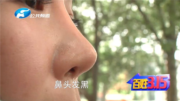 郑州康伦医院整形视频,郑州康伦整形失败案例